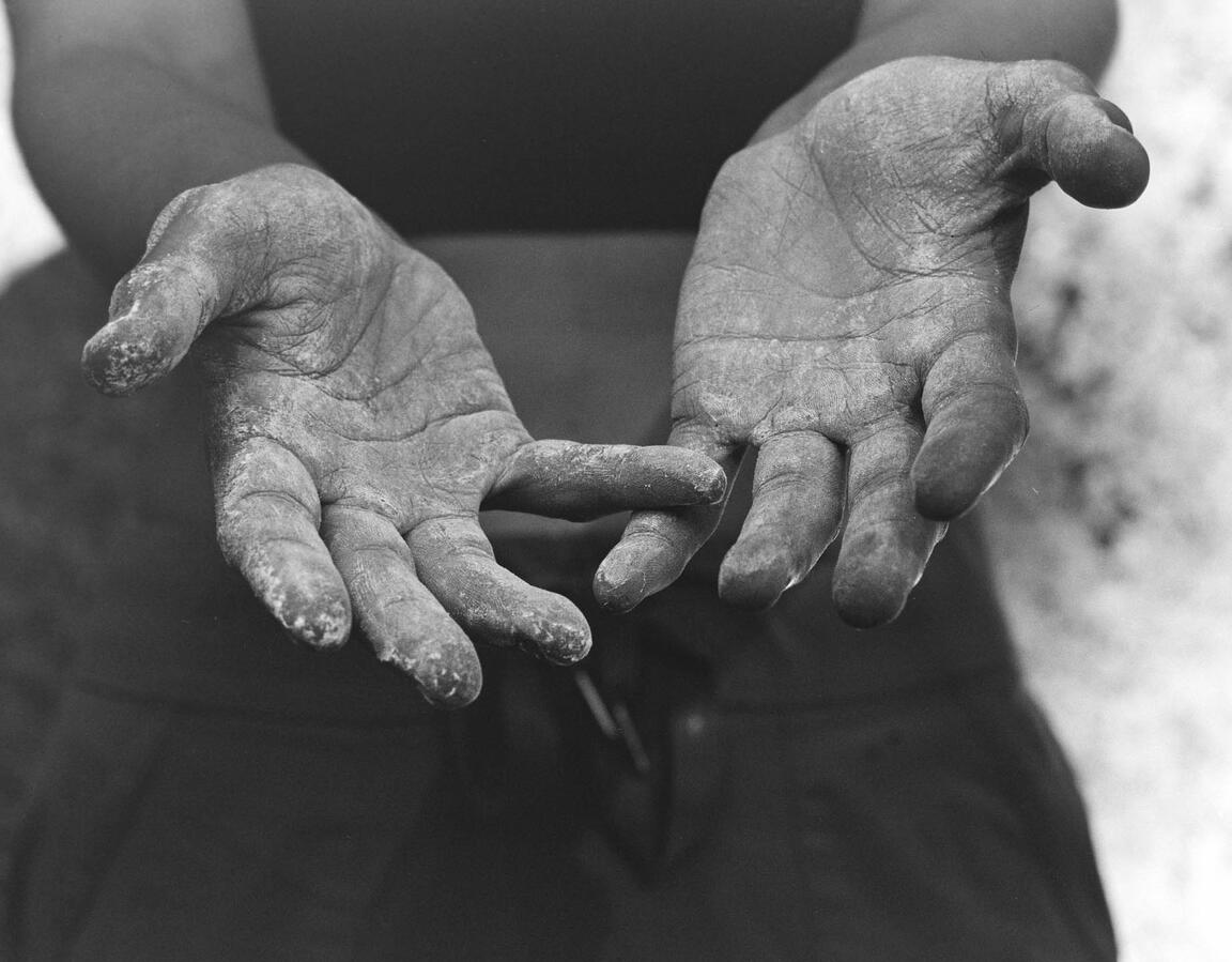 Climber Hands